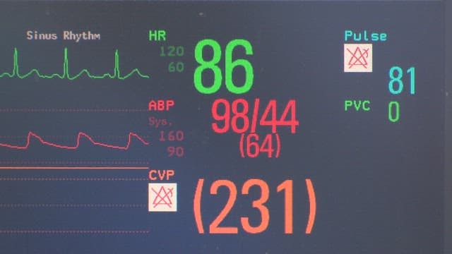 Hospital monitor showing vital signs, heart rate, and blood pressure readings