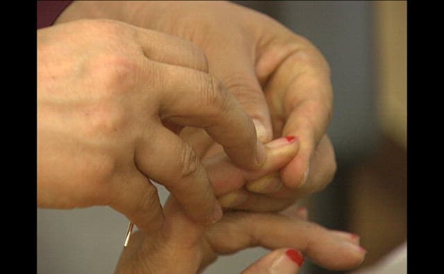 Doctor Treating a Patient with Acupuncture in Oriental Medical Clinic