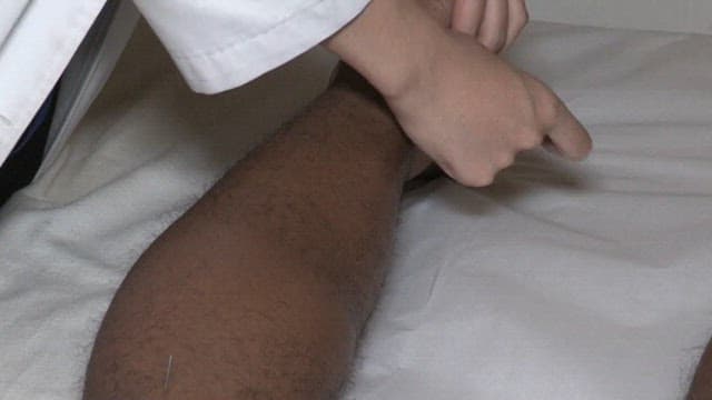 Doctor Treating a Patient with Acupuncture in Oriental Medical Clinic