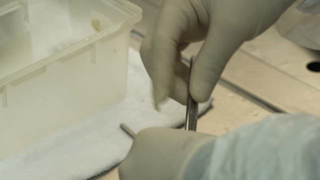 Gloved hand holding a surgical scalpel