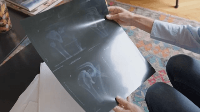 Reviewing Medical Documents and X-rays