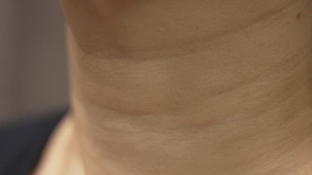 Close up of the wrinkles on the neck