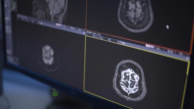 Display of Brain MRI Scans on a Monitor